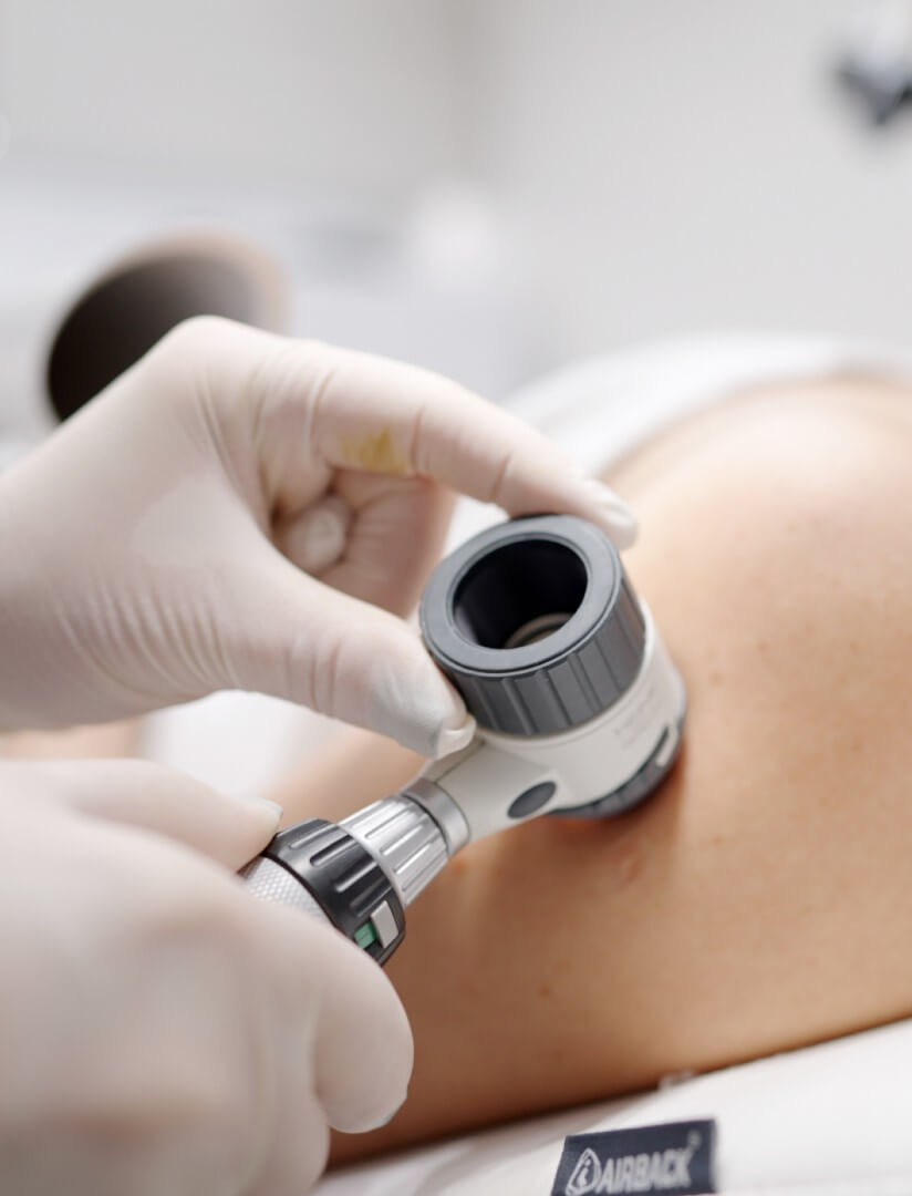 Dermatoscopy