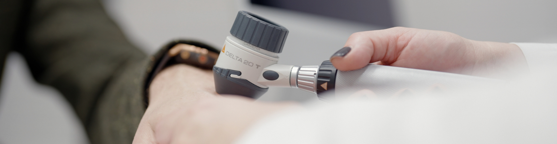 Dermatologė dermatoskopu vertina paviršinius kapiliarus ant paciento plaštakos prieš kapiliarų šalinimo lazeriu procedūrą