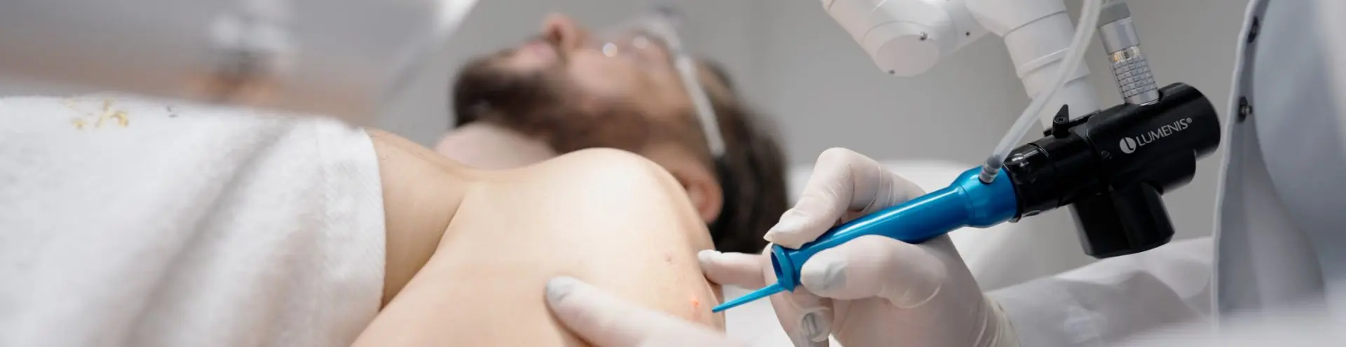 Dermatologas „Lumenis“ lazeriu šalina papilomą nuo vyro peties – papilomų šalinimas lazeriu