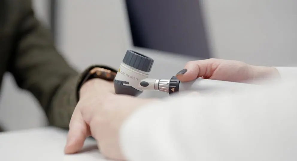 Dermatologė dermatoskopu vertina paviršinius kapiliarus ant paciento plaštakos prieš kapiliarų šalinimo lazeriu procedūrą